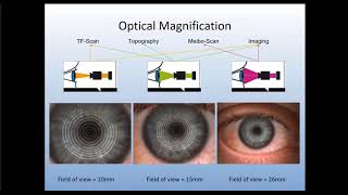 Online Seminar Marguerite McDonald Building amp Managing a Dry Eye Clinic of Excellence [upl. by Buehler196]