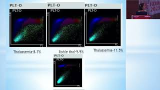 Automated FRC Count in Mindray BC6200  Effect of Microcytosis and Poikilocytosis [upl. by Euqinwahs]