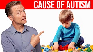 The REAL Cause of Autism Revealed Dr Berg Explains [upl. by Kroll]