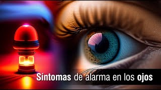 📌 4 síntomas de alarma en los ojos 👁️👨🏻‍⚕️ [upl. by Dudden920]