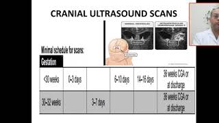 What are indications benefitadditional cranial ultrasound scans in preterm babies 33 weeks LBW [upl. by Hudnut264]