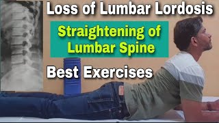 Loss of Lumbar Lordosis Exercises in Hindi  Straightening of Lumbar Spine  Spine Curvature [upl. by Myrilla]