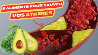 5 aliments pour sauver vos artères  maladie cardiaque  crise cardiaque  cardiac catheterization [upl. by Quillon]