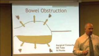 Bowel Obstruction Gas Pattern and Presentations [upl. by Tnomal]