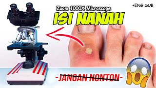 INILAH ISI NANAH DI MIKROSKOP  Pus Under Microscope Zoom 1000X [upl. by Oconnor]