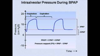 NonInvasive Positive Pressure Ventilation Mechanical Ventilation  Lecture 6 [upl. by Stephenie579]