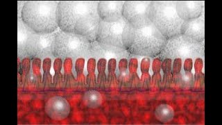 Necrotizing Enterocolitis NEC Part 2 Animation by Cal Shipley MD [upl. by Mendive]