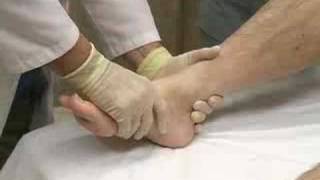 Dislocation Reduction Ankle sample  proceduresconsultcom [upl. by Aselehc161]