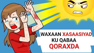 Sheeko  Waxaan Xasaasiyad Ku Qabaa Qoraxda Sheeko sheekocaruureed sheekoxariiro qiso ifiye [upl. by Hinckley686]