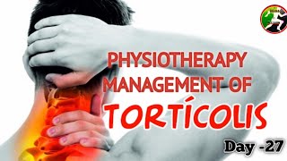 Day 27  Physiotherapy management of Torticolis Wry neck  Spasmodic torticolis [upl. by Nodnarbal173]