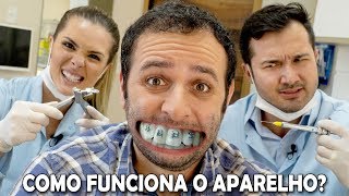 Como o aparelho desentorta os dentes Boravê [upl. by Aloysia]