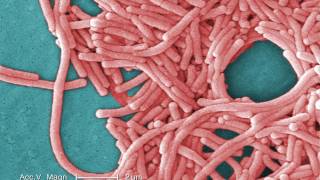 Legionnaires Disease What You Need to Know [upl. by Zerelda]