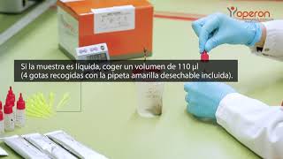 Test rápido GDHToxins para la detección diferencial de GDH y toxinas A y B de Cdifficile [upl. by Aissenav659]