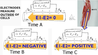 Electromyography EMG Biopac lecture [upl. by Gerry]