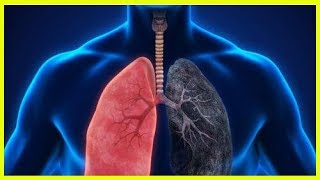 8 symptômes de la pneumonie que vous ne pouvez pas ignorer [upl. by Cloutman]