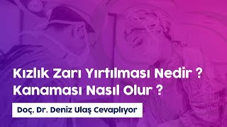 Kızlık zarı kanaması nasıl olur  Doç Dr Deniz Ulaş [upl. by Courcy]