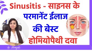 Sinusitis symptoms causes amp treatment by best homeopathic medicines [upl. by Nnylamme]