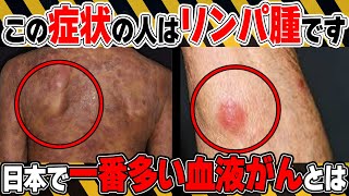 【日本で一番多い血液がん】絶対に見逃さないで！悪性リンパ腫の初期の危険サインとは？予防法についても医師が徹底解説！【医師監修】【悪性リンパ腫は】 [upl. by Lyris]