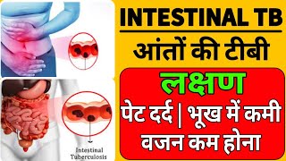 Intestinal TB Abdominal TB  Cause Symptoms Treatment  आंतों की टीबी कारण लक्षण उपचार [upl. by Airakaz]