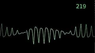 Torsades de Pointes heart monitor animation [upl. by Berky]