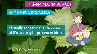 Newborn Baby Rash  Part 4 Miliaria Crystallina and Miliaria Rubra Causes amp Treatment  Heat Rash [upl. by Ecnahc]