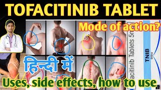 Tofacitinib 5 mg tablet uses side effects how to use in hindi tofacitinib [upl. by Morel]