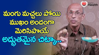 Melasma  మంగు మచ్చలు పోయి ముఖం అందంగా Dr Chittibhotla Madhusudana Sarma  TeluguOne Health [upl. by Neils987]