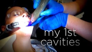 MY FIRST CAVITIES [upl. by Jamesy]