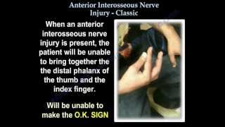 Anterior Interosseous Nerve Injury Classic  Everything You Need To Know  Dr Nabil Ebraheim [upl. by Katleen]