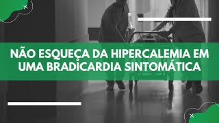 VOCÃŠ NÃƒO PODE ESQUECER DISSO AO ANALISAR UM ECG DE DISTÃšRBIO HIDROELETROLÃTICO [upl. by Gnem]