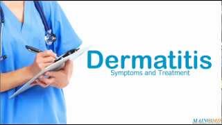 Dermatitis Symptoms and Treatment [upl. by Kcub]