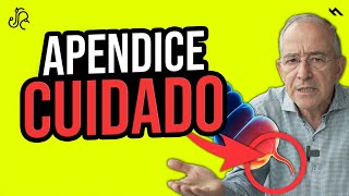 APENDICE CUIDADO TE PUEDE MATAR Apendicitis y Peritonitis  Oswaldo Restrepo RSC [upl. by Notlil]