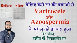 Azoospermia with varicocele successfully treated with unani system of medicine by Dr Nizamuddin Sir [upl. by Ingemar]