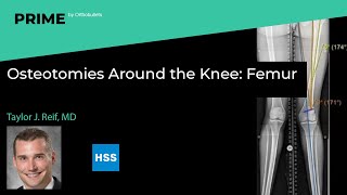 Osteotomies Around the Knee Femur  Taylor J Reif MD [upl. by Stinky]