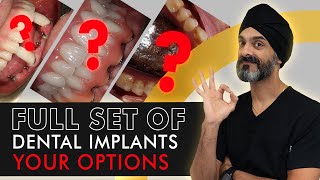 OPTIONS WITH A FULL SET OF DENTAL IMPLANTS  What You Need to Know [upl. by Nisaj]