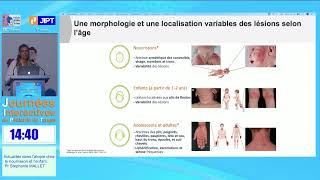 Actualités dans latopie chez le nourrisson et lenfant  Pr Stéphanie MALLET  JIPT Maroc 2023  P1 [upl. by Saihtam67]