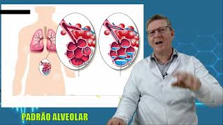 CURSO DE RADIOLOGIA PADRÃO ALVEOLAR [upl. by Asilet36]