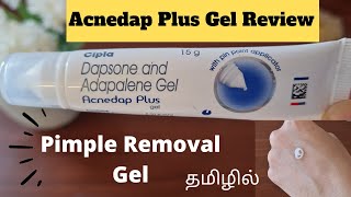 PRODUCT REVIEWEPI23ACNEDAP PLUS GEL REVIEWDAPSANE amp ADAPALENE GEL REVIEWPIMPLE REMOVAL GELACNE [upl. by Mauralia]