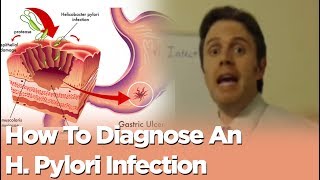 How To Diagnose An H Pylori Infection [upl. by Nylyaj]