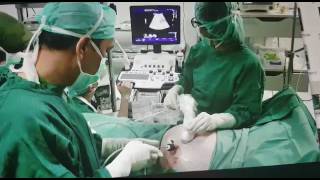 Fetoscopy by dr Gatot Abdurrazak SpOGK [upl. by God8]