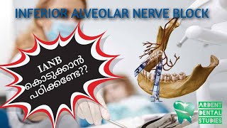 Inferior alveolar nerve block IANBHow to block IANMandibular nerve blockDental blockAnimation [upl. by Drud]