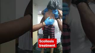 scoliosis treatment 93085113578409313131 [upl. by Pelaga]