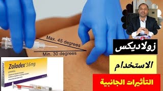 ابرة زولادكس zoladex  الجرعة والاستخدام والاعراض الجانبية [upl. by Jemena]