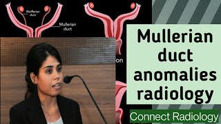 Mullerian duct anomalies radiology PART 2 [upl. by Slen]