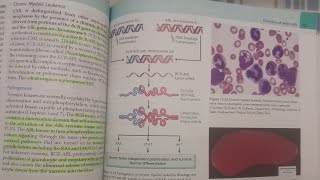 Chronic Myeloid Leukemia  SPECIAL PATHOLOGY [upl. by Ion551]