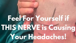 How to Check To See if Your Chronic headache is Coming from an Occipital Nerve Entrapment [upl. by Lidaa197]