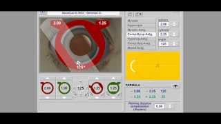 Retinoscopy Simulator Tutorial  Retinoscopy part 2 [upl. by Ahselyt]