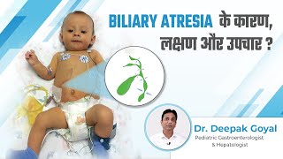 Biliary Atresia के कारण लक्षण और उपचार  Biliary Atresia Baby  Dr Deepak Goyal [upl. by Nywra]