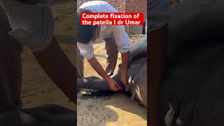 Complete fixation of the patella l dr Umar khan [upl. by Cecilla]