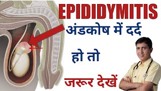 Epididymitis SymptomsCauses And Treatment Homeopathic Medicine Testicular Pain DrRamdeo Lamoria [upl. by Xerxes958]